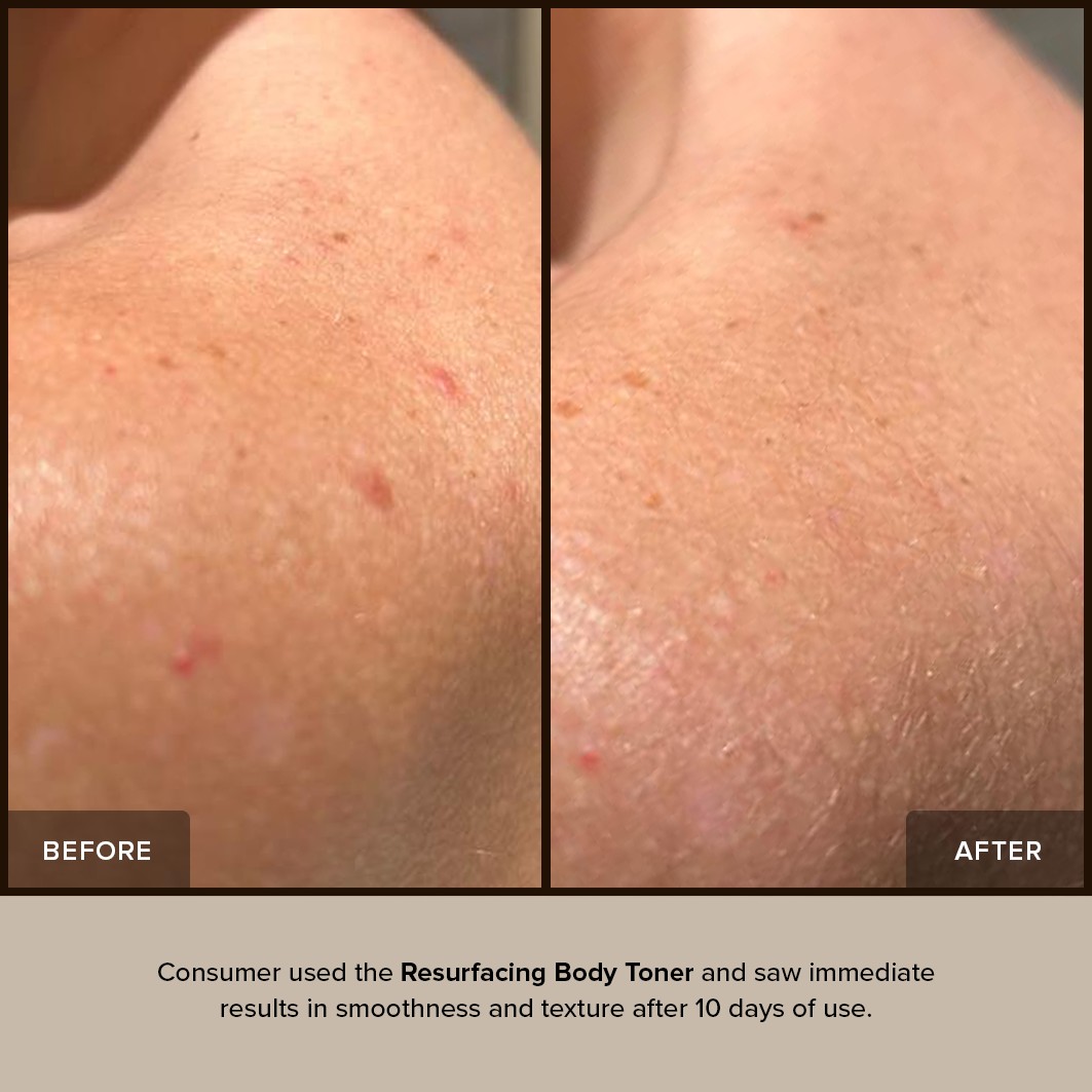 Resurfacing Body Toner
