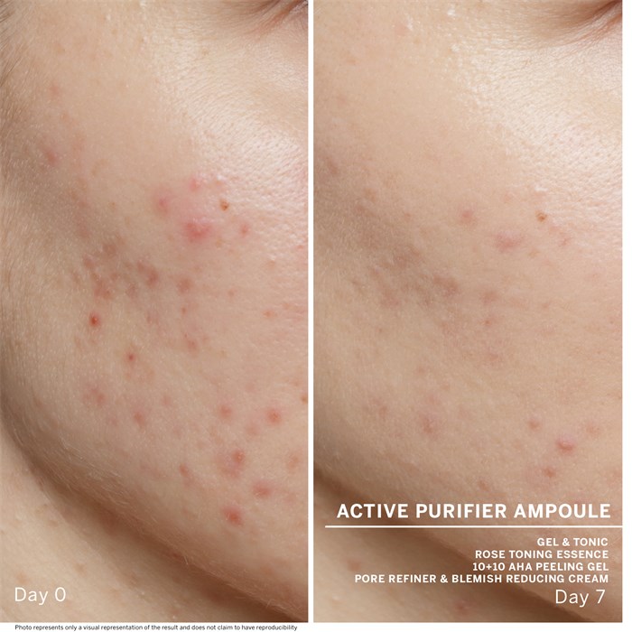 Active Purifier 7 Ampoules