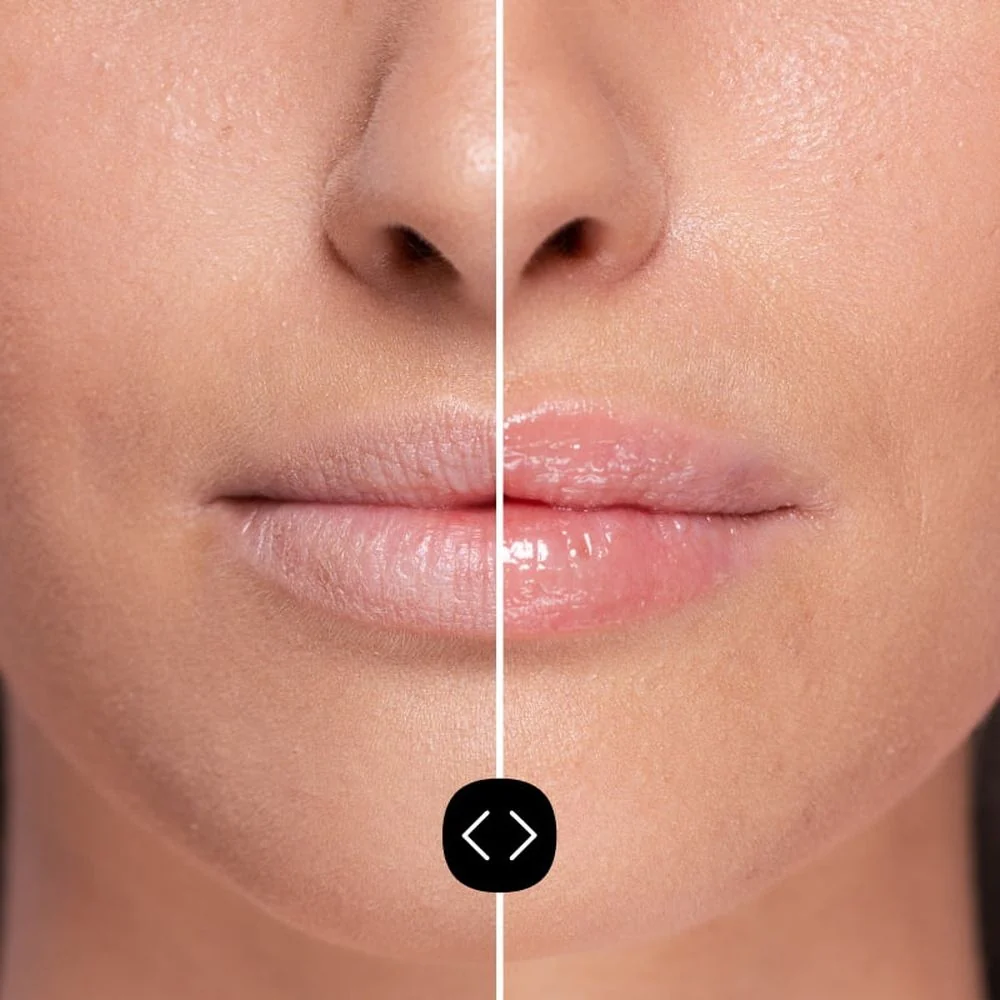 Gloss Labial Volumizador com Ácido Hialurônico, Preenchedor de Lábios