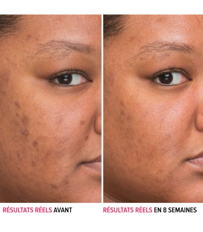 IT COSMETICS-SERUM BYE BYE DARKSPOTS-Sérum anti-taches à la niacinamide