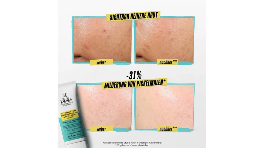 KIEHL'S Expertly Clear Blemish Treating & Preventing Lotion 60 ml