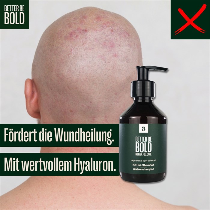 Pflegendes Glatzenshampoo (0-6mm)