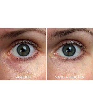 VITAYES Perfector Augenserum-15 ml