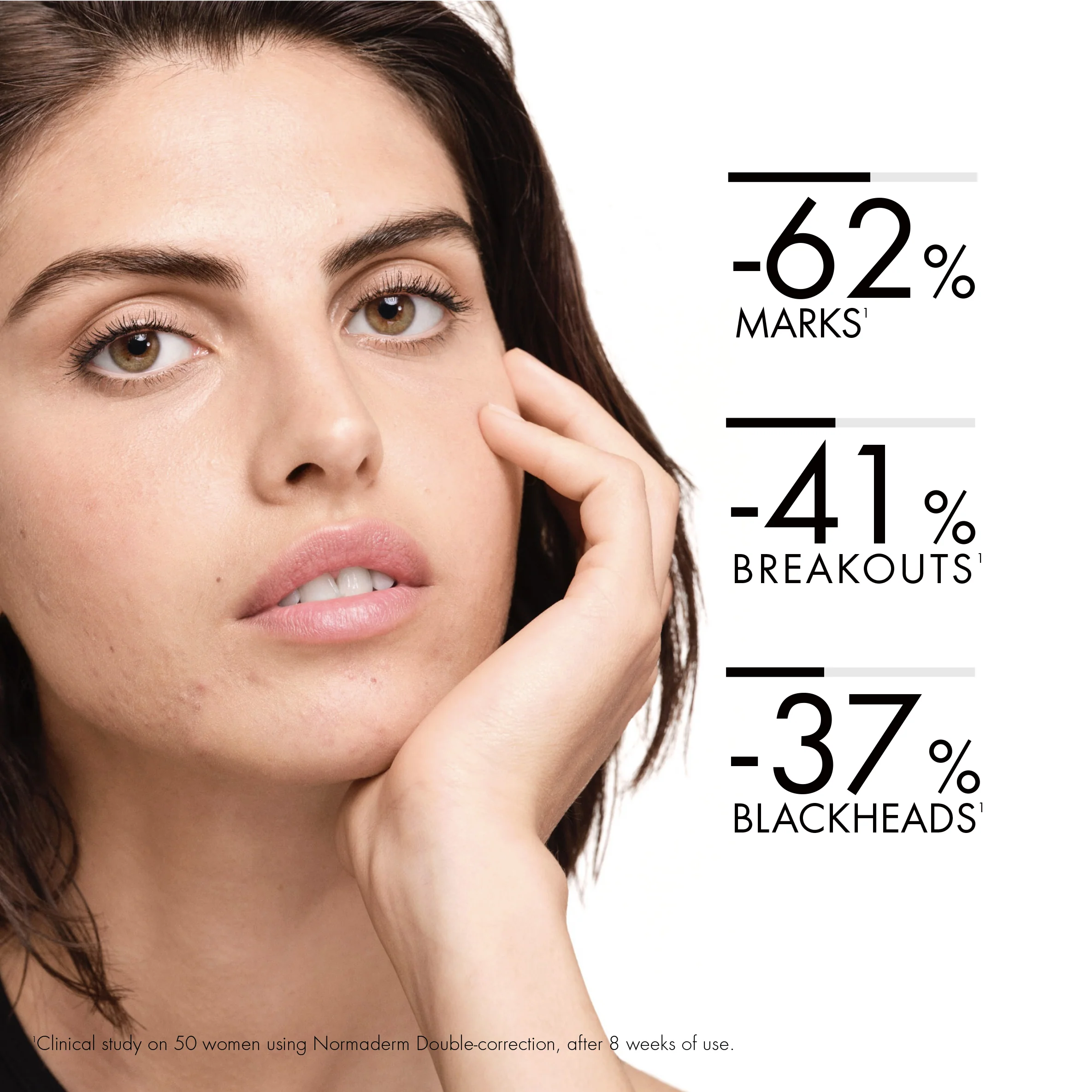 Normaderm Double Action Fuktighetsgivende Behandling - Anti-Blemish Ansiktsserum