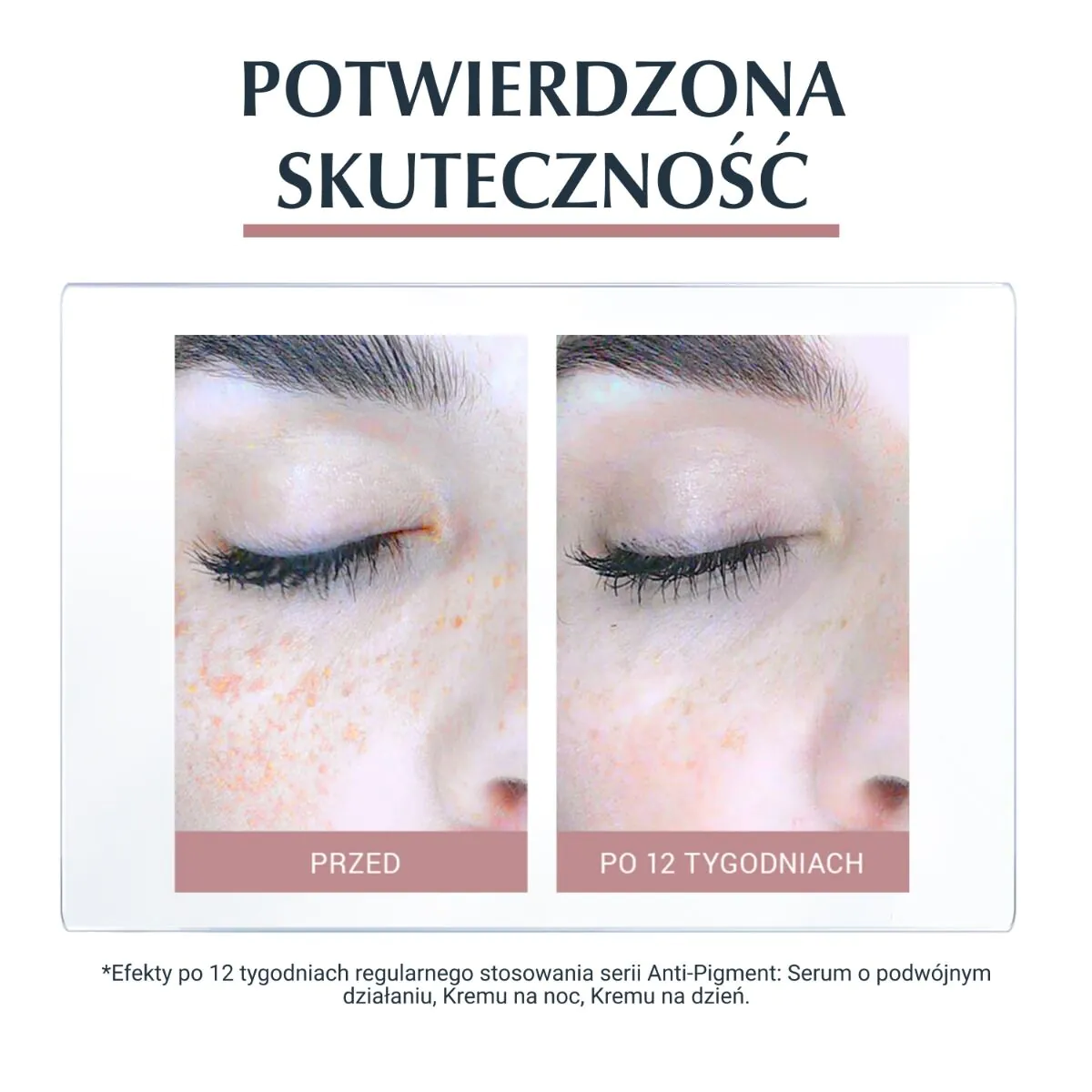 Eucerin dvigubo poveikio serumas nuo pigmentacijos