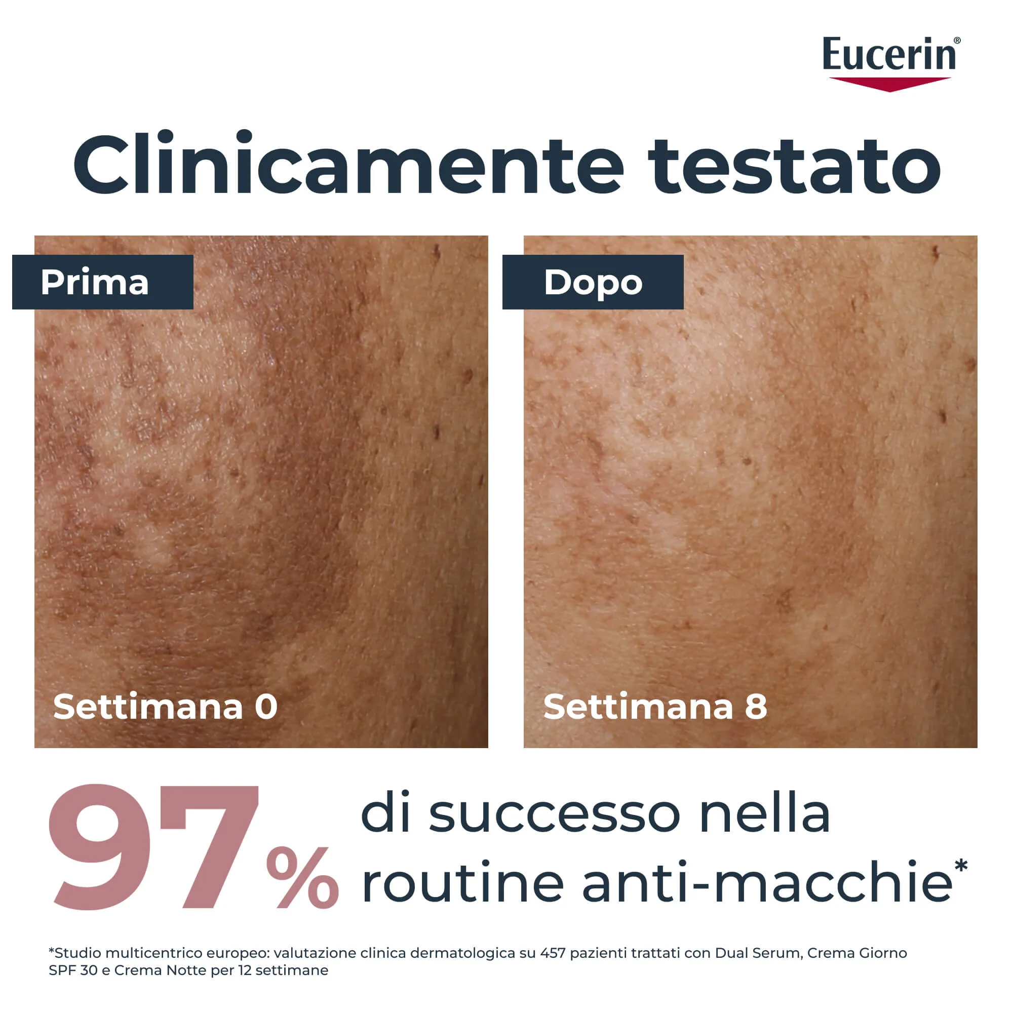 Anti-Pigment Anti-Pigment Serum - Siero viso antimacchie