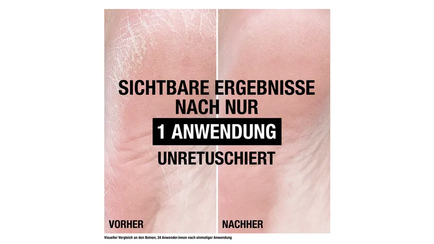 Neutrogena Norwegische Formel Intense Repair Reparierender Fußbalm 50 ml