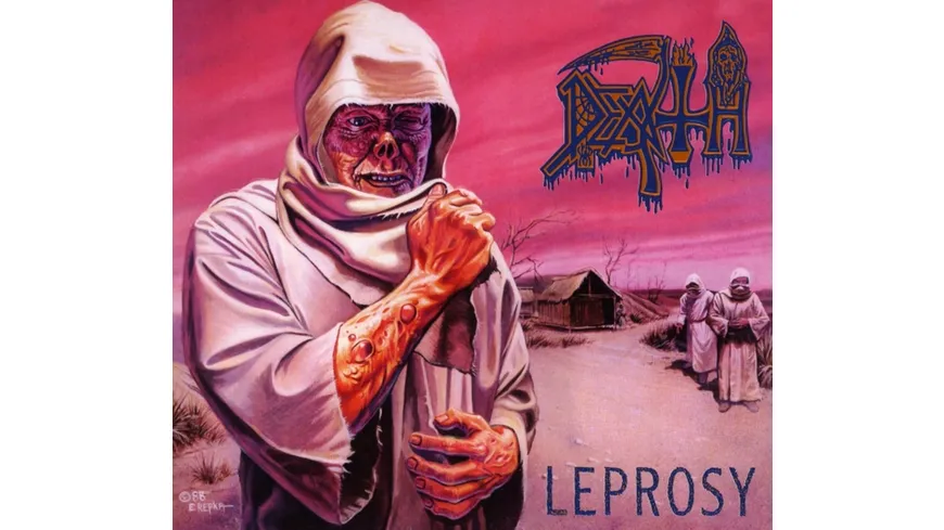 Leprosy