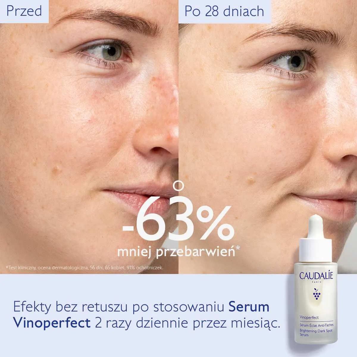 Caudalie Vinoperfect Ορός Λάμψης για Αποχρωματισμό