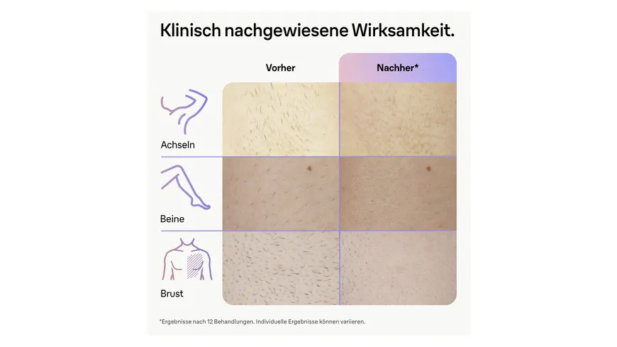 BRAUN IPL-Haarentfernungsgerät Skin i·expert PL7147 Weiß / Bronze