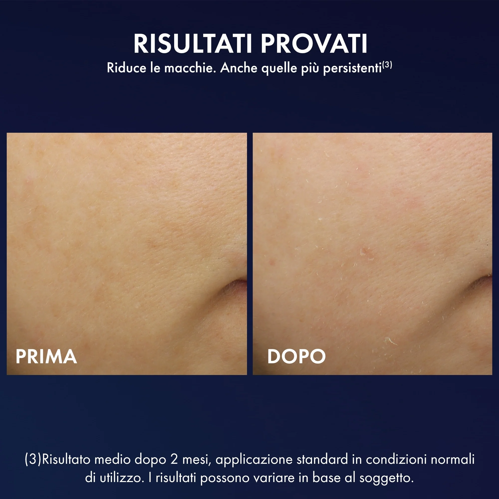 Liftactiv Liftactiv B3 Natcreme med Retinol - Anti-rynke natbehandling