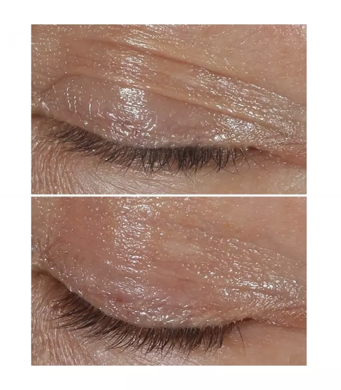 CLINIQUE SMART Clinique Smart Clinical Repair - Crème Yeux Correction Rides