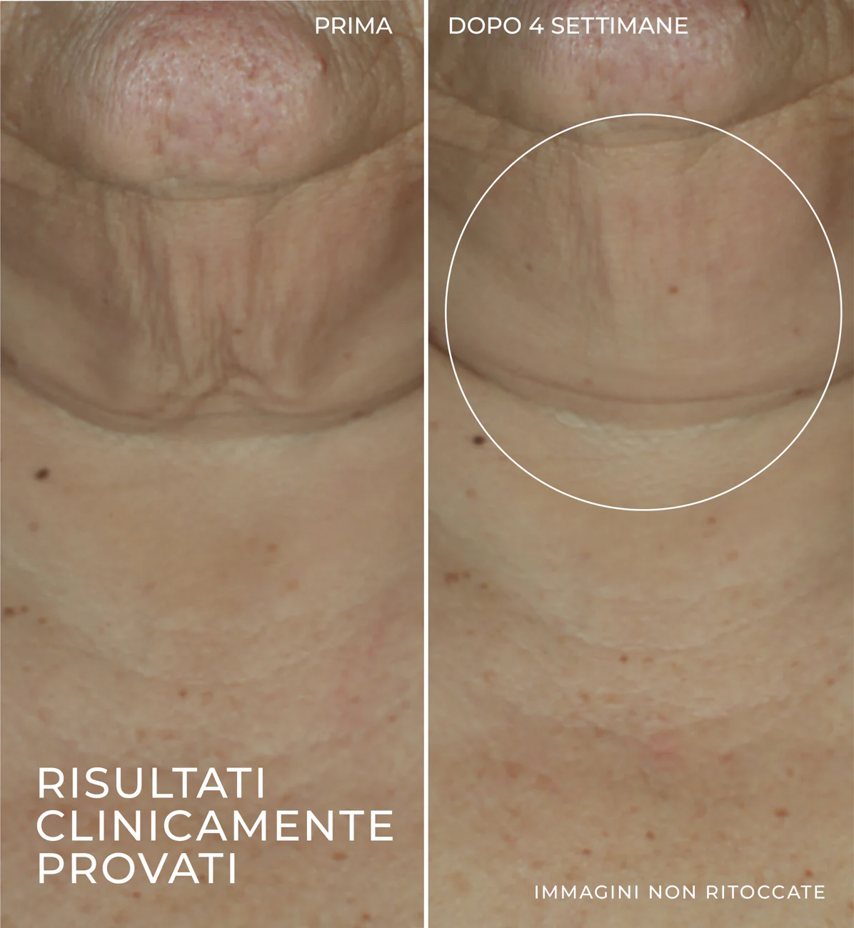 Derm Correxion serum za učvršćivanje kože u stiku - Lifting u stiku, Siero visi lifting