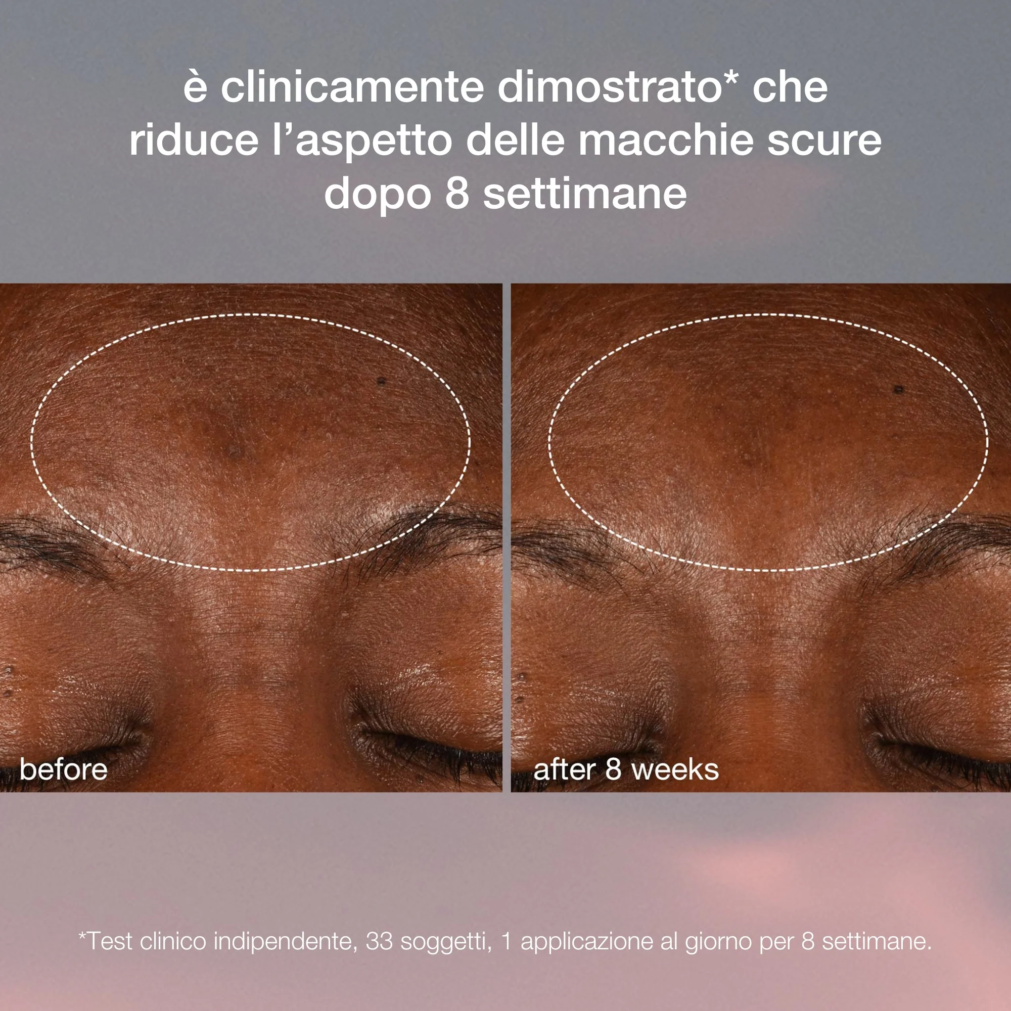 Dynamic Skin Recovery FPS 50 - Creme de dia antirrugas, Tratamentos Protetores