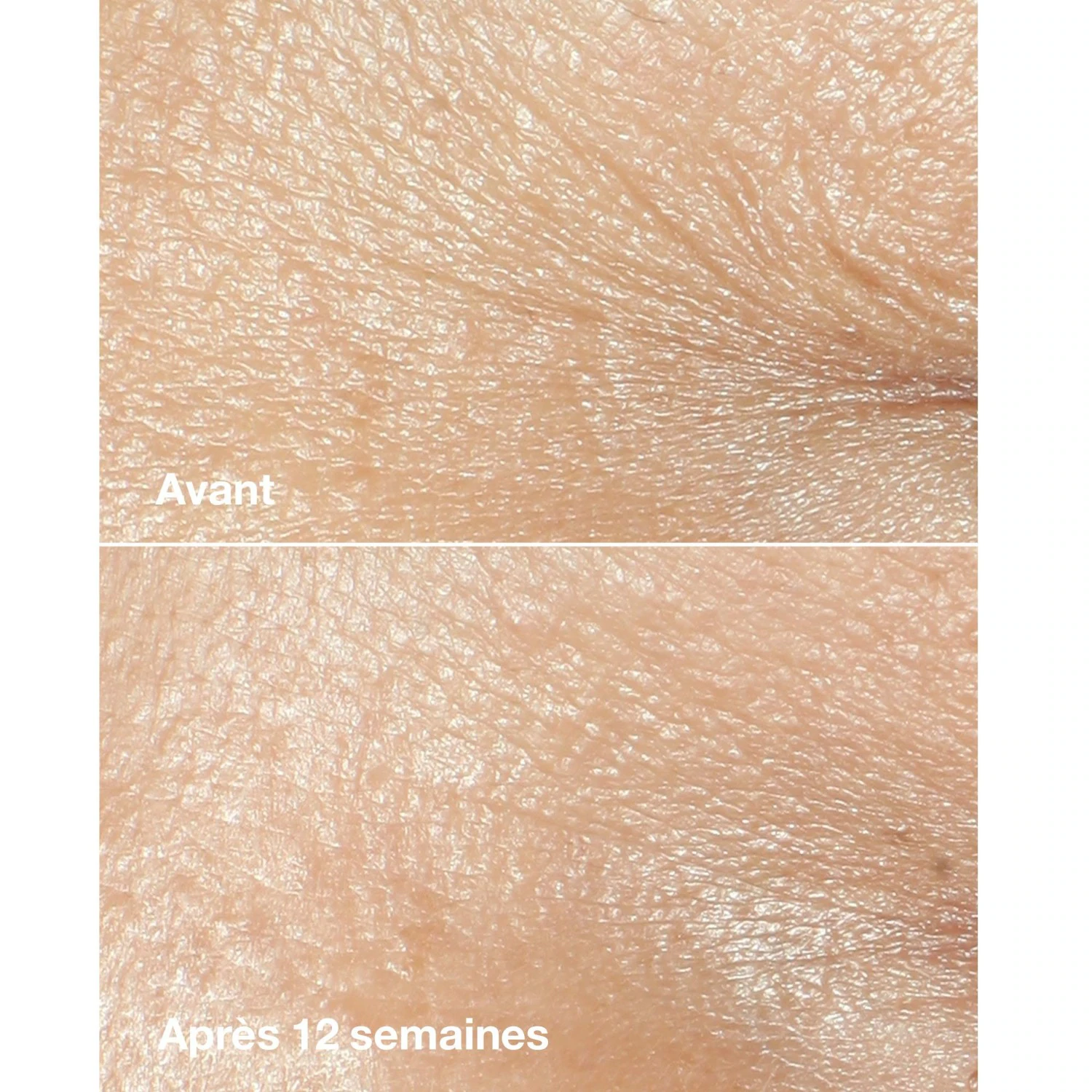 Crema correttiva antirughe Clinique
