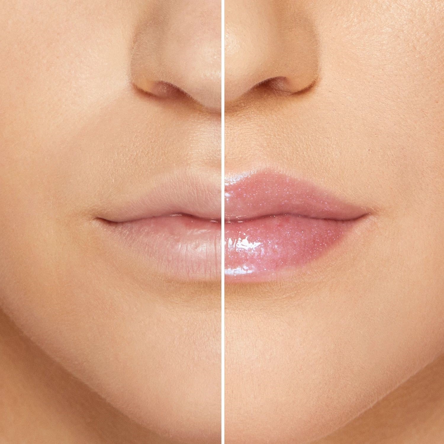 Lip Injection Maximum Plump