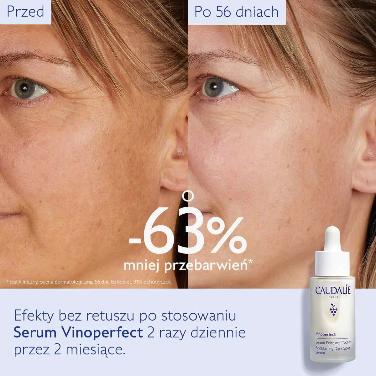 Caudalie Vinoperfect Ορός Λάμψης για Αποχρωματισμό