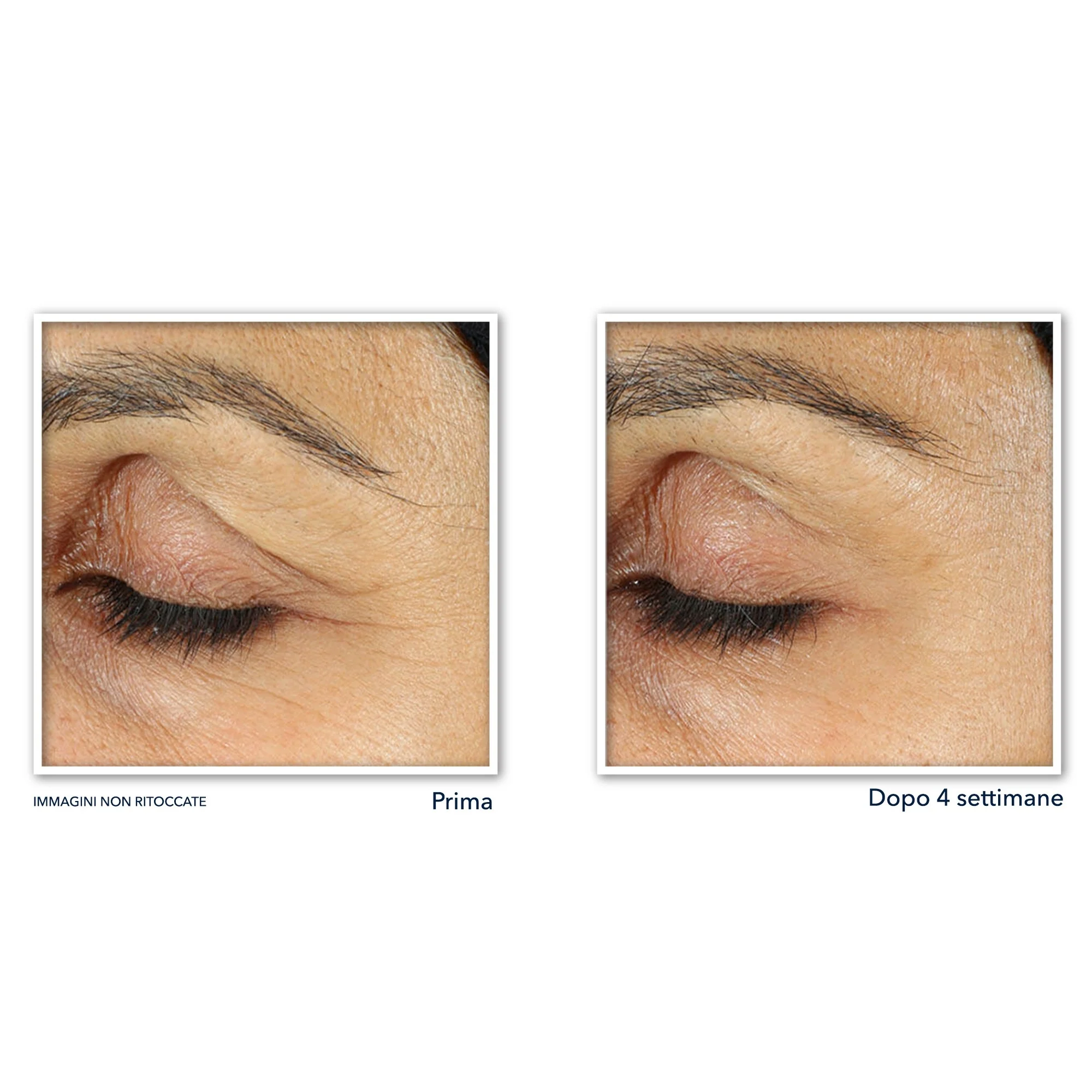 Retinol Correxion Line Smoothing Eye Cream - Behandling mod poser og mørke rande under øjnene, Antirynkebehandling under øjnene