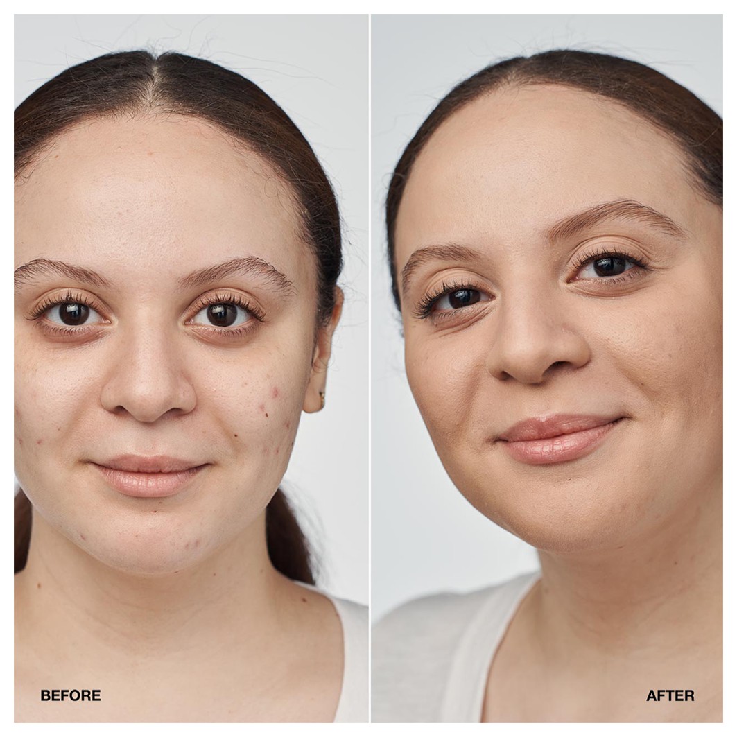 CLINICAL SERUM FOUNDATION SPF 20
