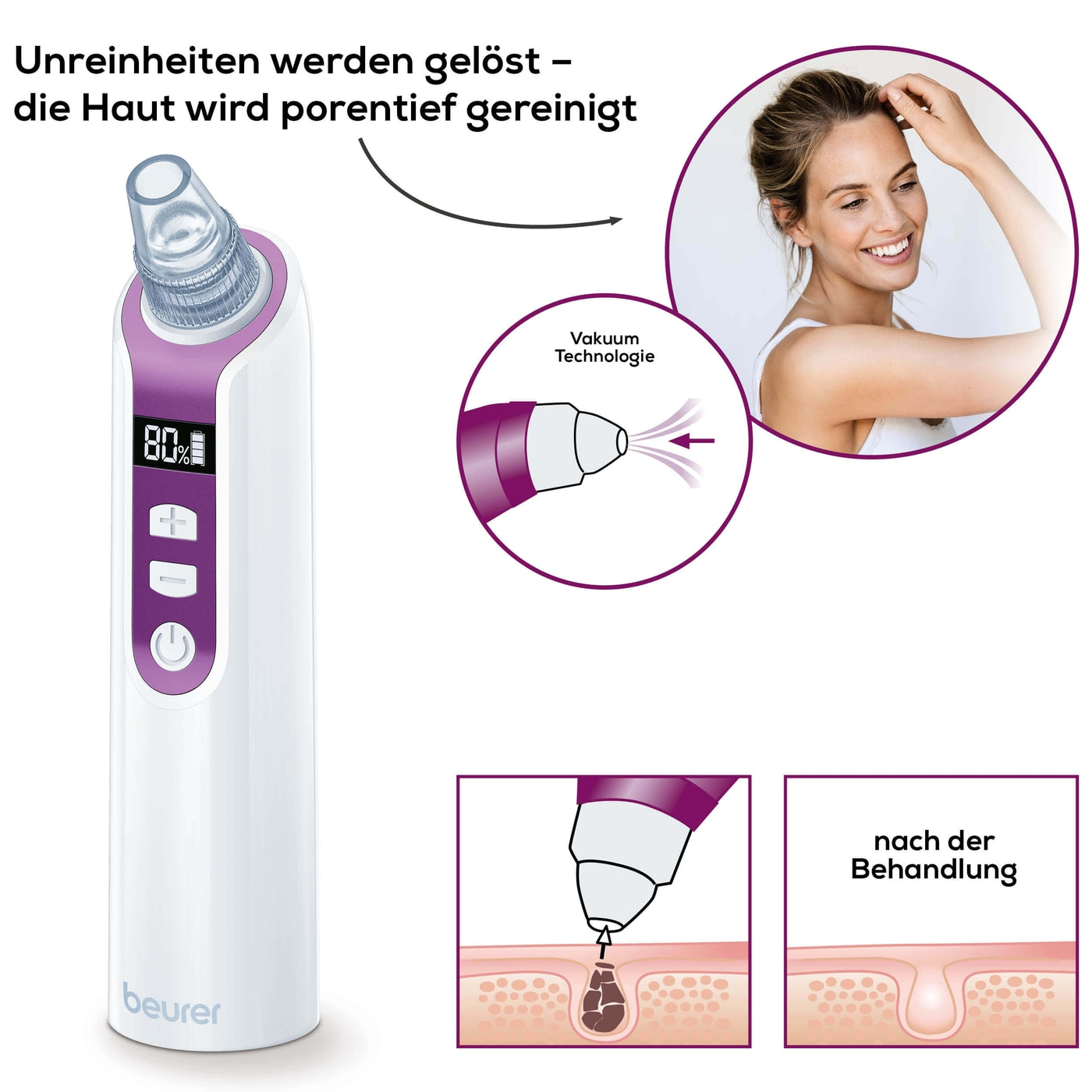 Beurer Porenreiniger FC 41-Mitesserentferner und porentiefe Reinigung dank Vakuumtechnologie